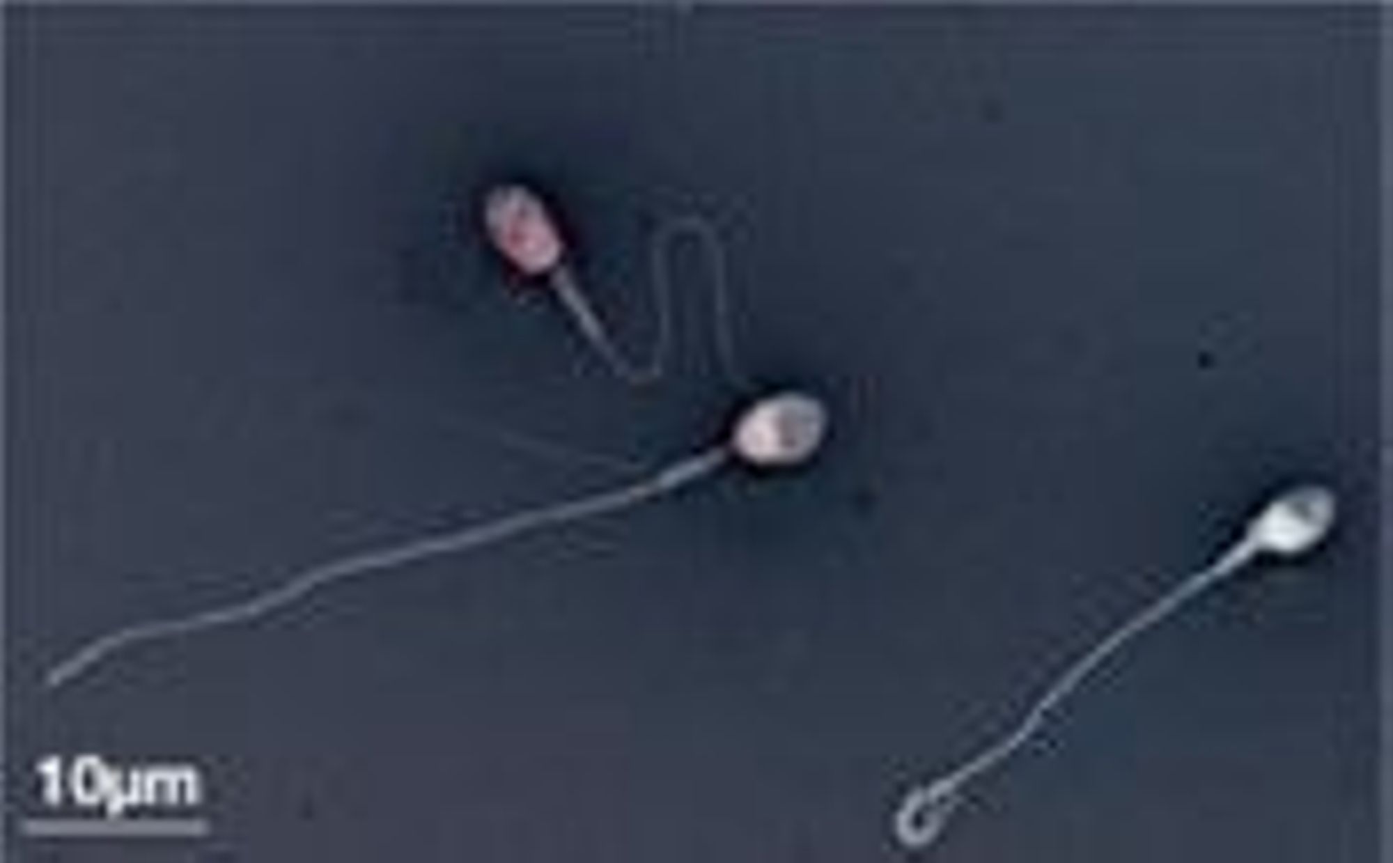 Test d'exclusion de coloration (les spermatozoïdes roses sont morts, les blancs sont vivants)