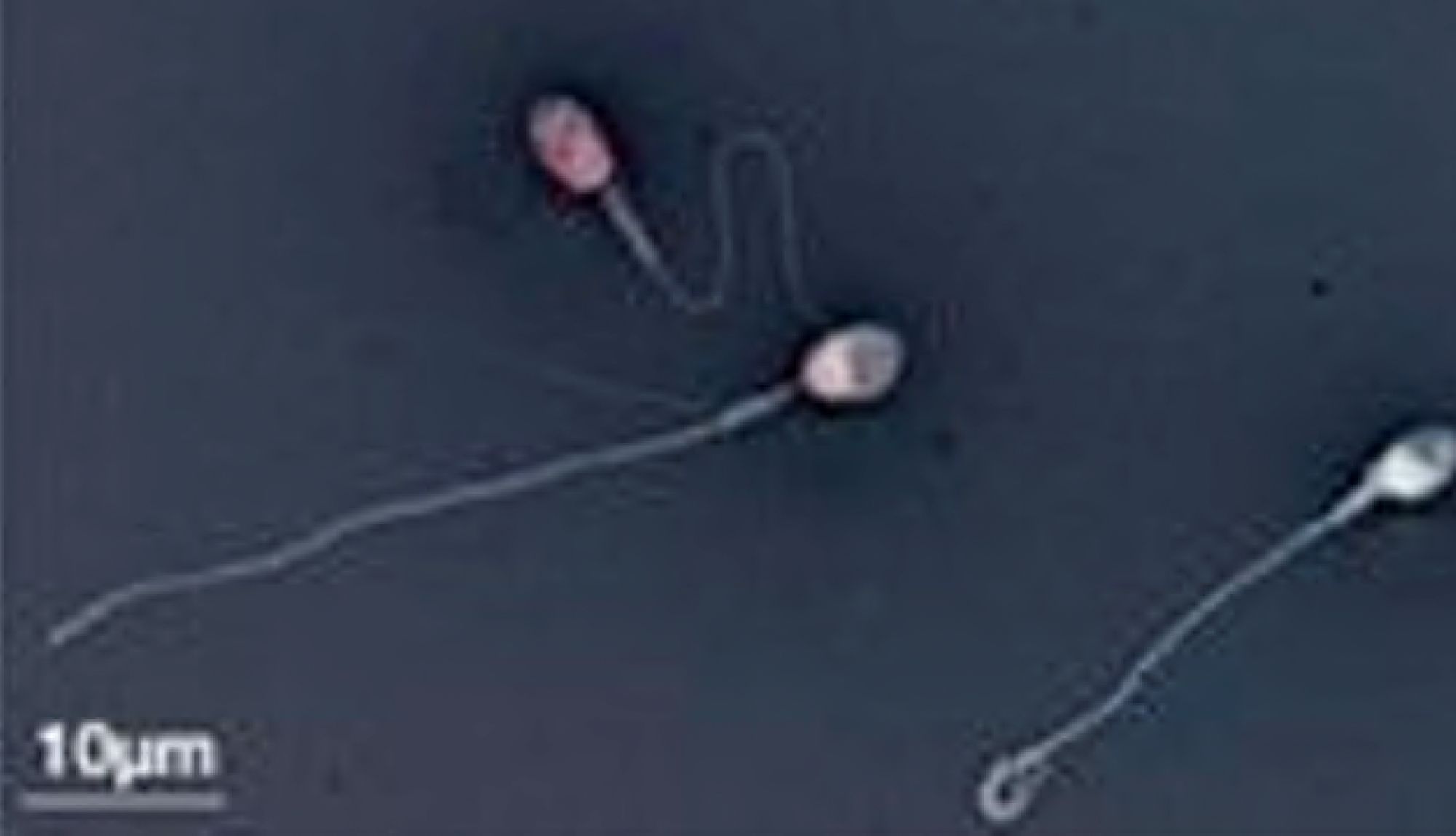 Comment optimiser les paramètres spermatiques et les chances de grossesse naturelle