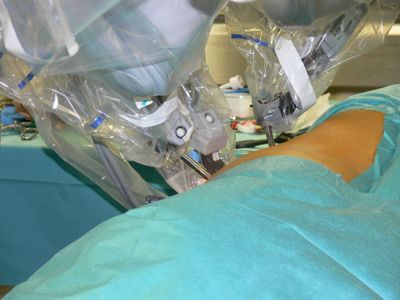 Robot Chirurgie Urologie