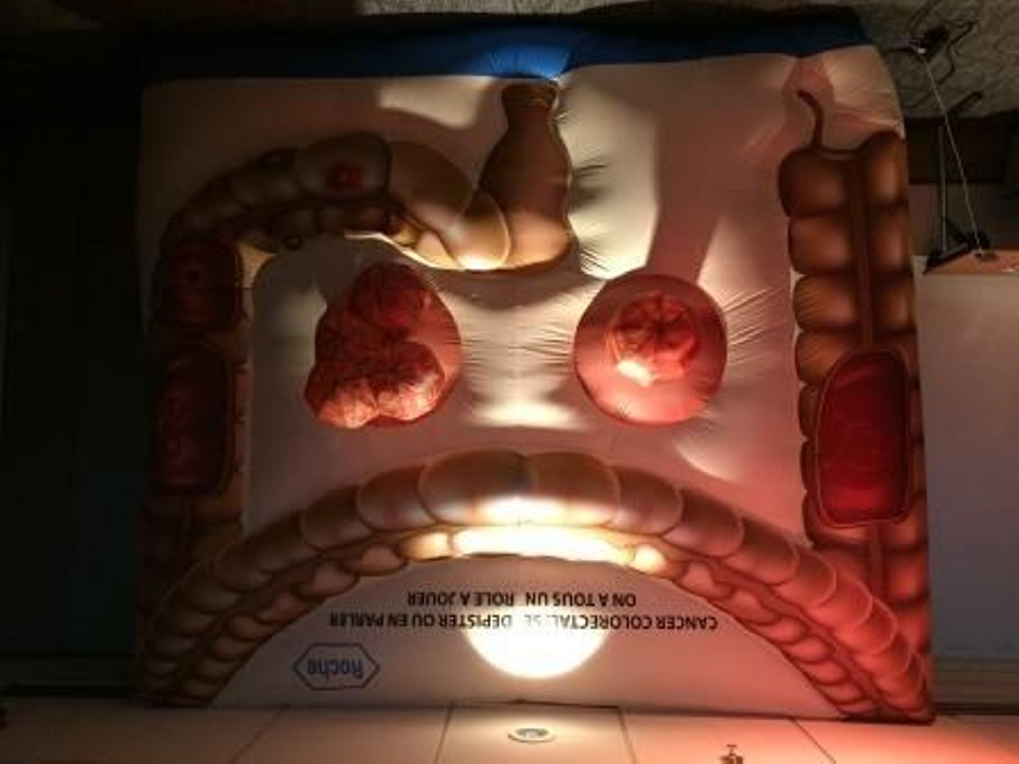 Lundi 6 mars 2017: Mars Bleu à l'Hôpital Saint Joseph, journée d'information sur le cancer du colon