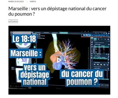 Marseille : vers un dépistage national du cancer du poumon ?