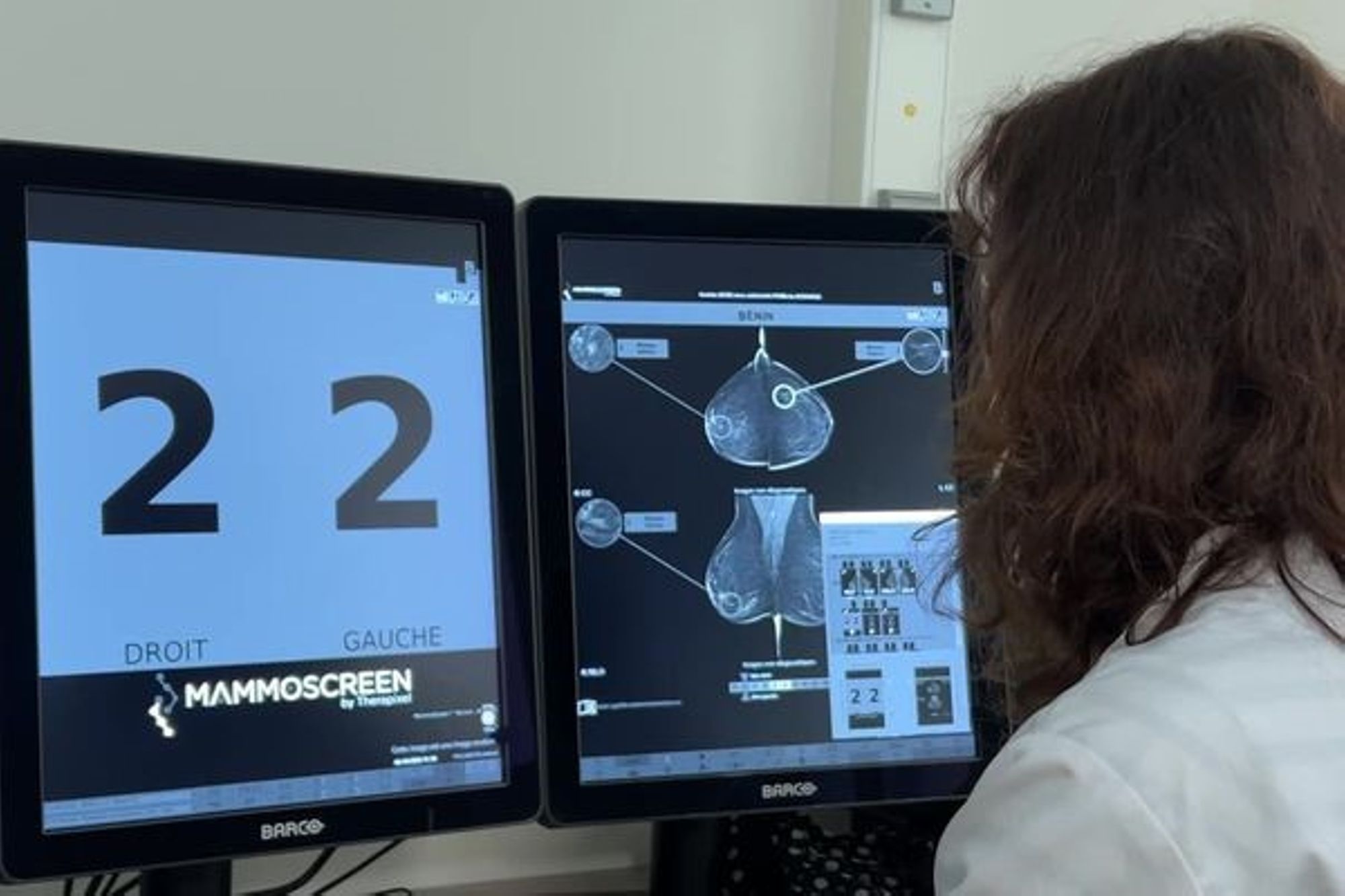 France info TV, 13/10/2024 : "Voir des lésions plus petites et de les prendre en charge plus rapidement", l'Intelligence Artificielle au service du dépistage du cancer du sein