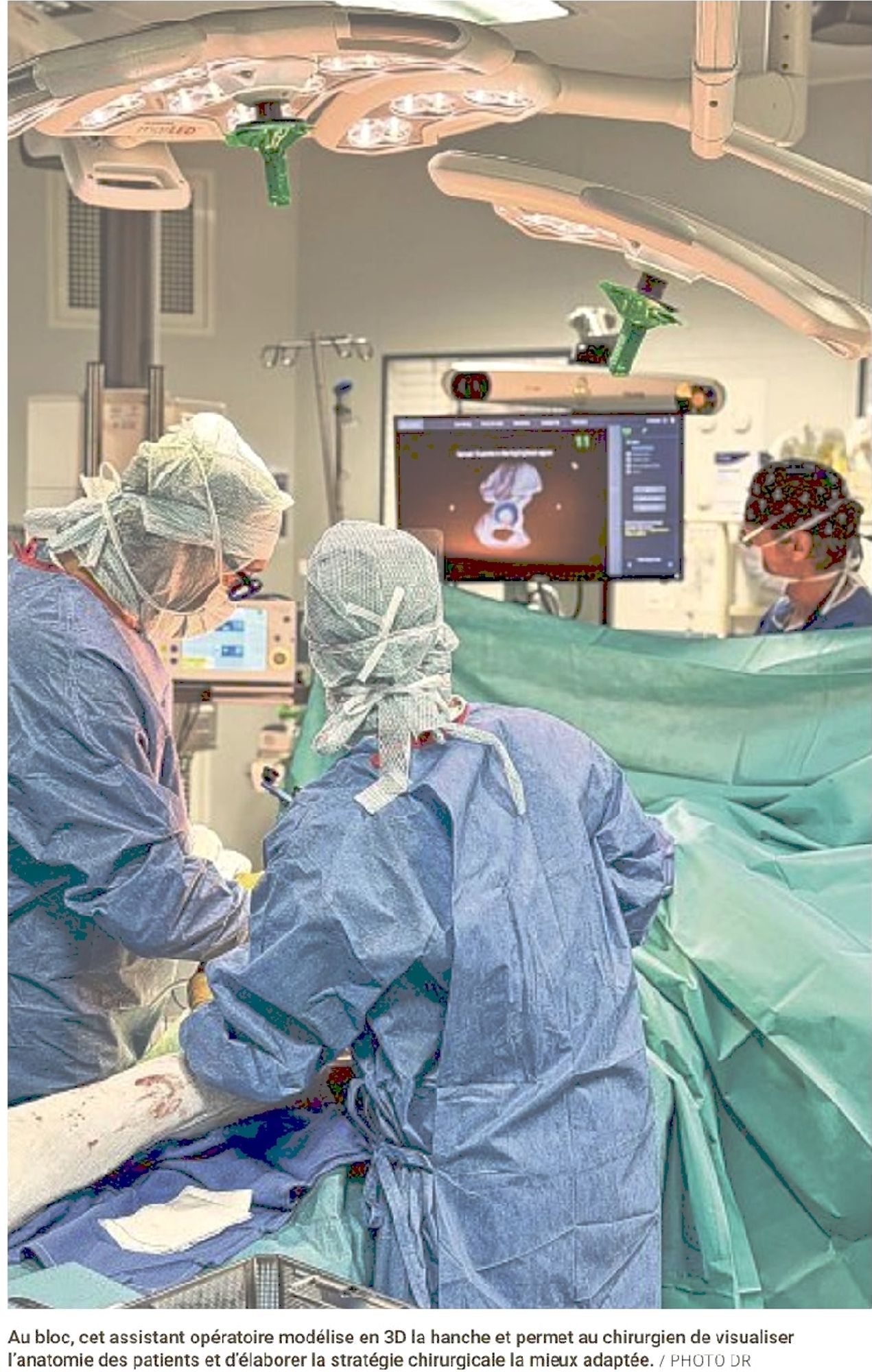 La Provence, 03/02/2025 : Arthrose de hanche : gros plan sur une chirurgie de pointe