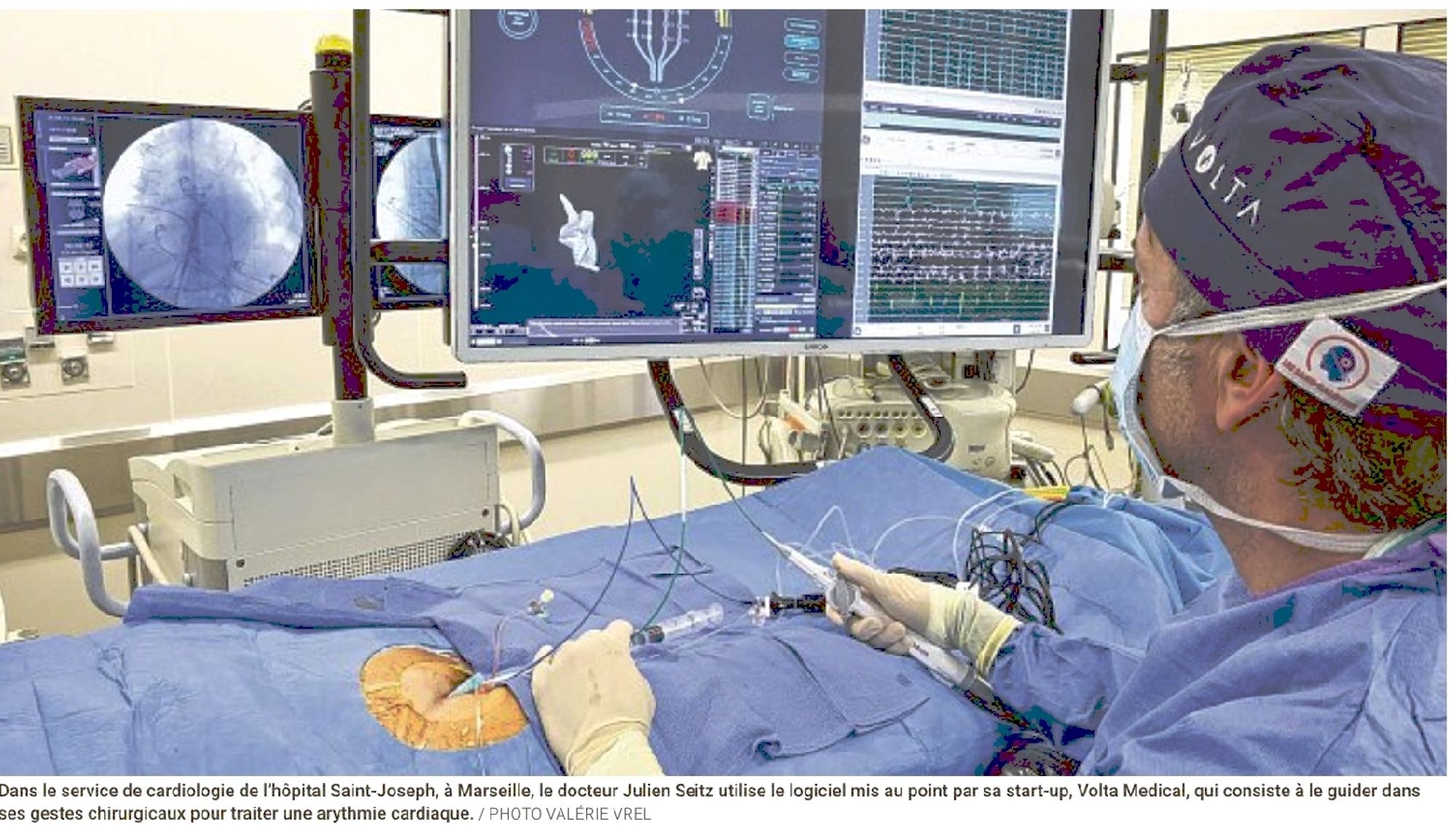 La Provence, 15/02/2025 : Marseille révolutionne l'arythmie