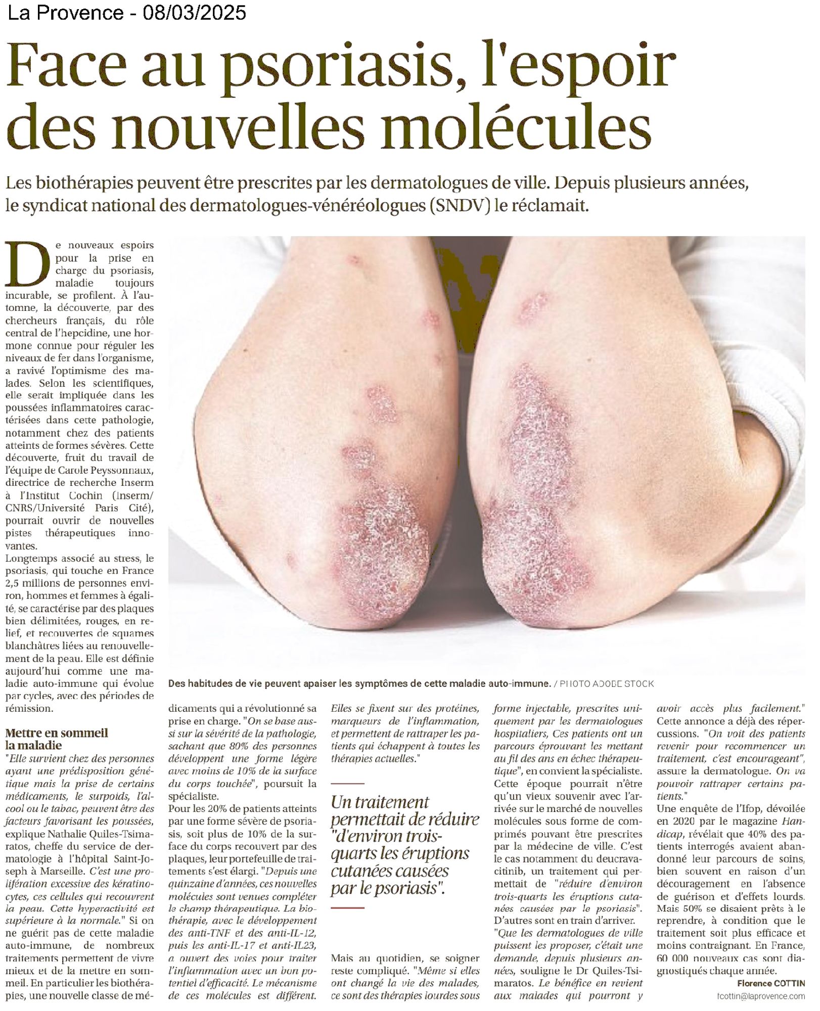 La Provence, 08/03/2025 : Face au psoriasis, l'espoir des nouvelles molécules