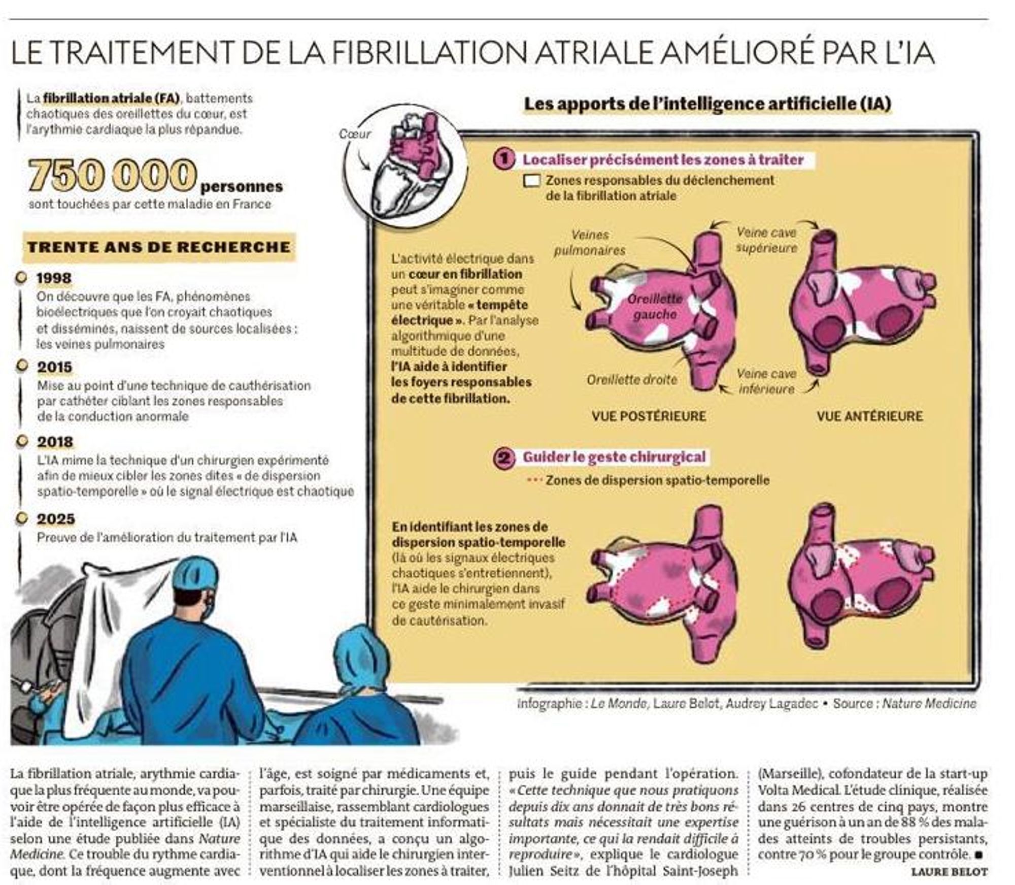 Le Monde, 19/03/2025 : Le traitement de la fibrillation atriale amélioré par l’IA
