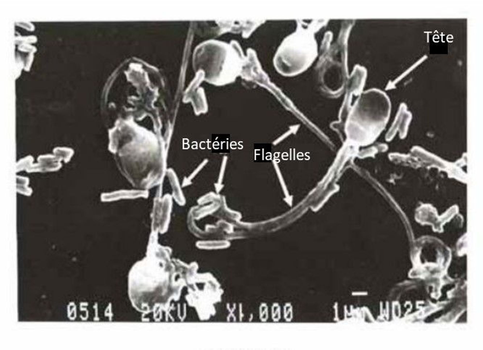 La spermoculture (en collaboration avec le laboratoire de microbiologie de l'Hôpital Saint Joseph) (copie)