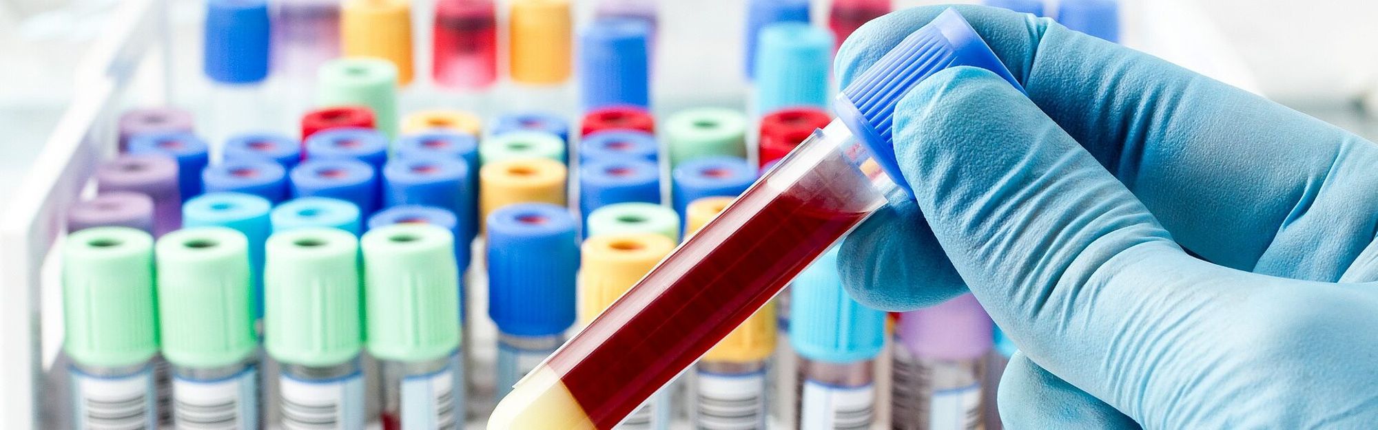 Laboratoire : Accès au Manuel de prélèvement - Catalogue des examens