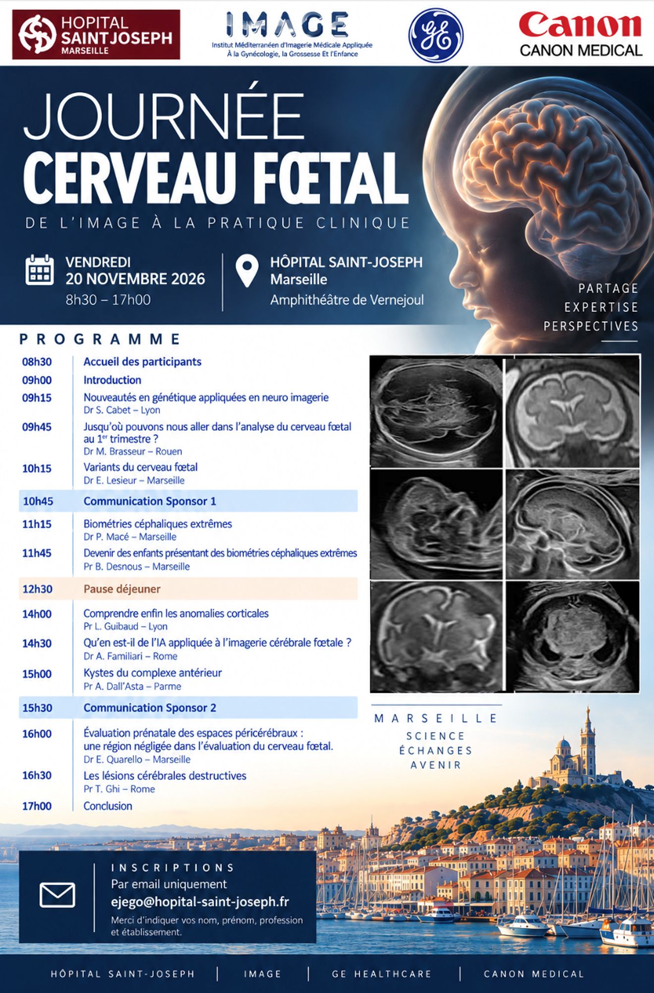 Journée Cerveau Fœtal - Vendredi 20 novembre : un colloque scientifique dédié à la neuro-imagerie prénatale