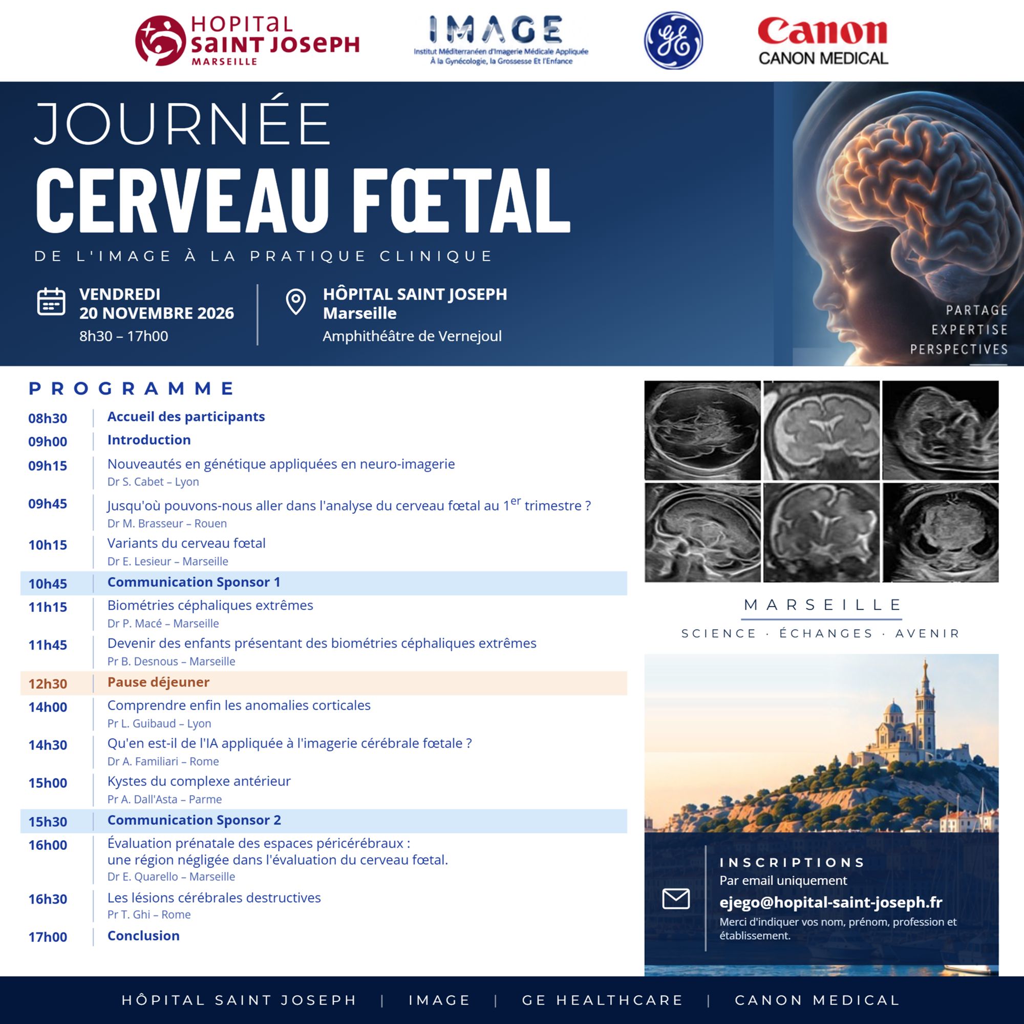 Journée Cerveau Fœtal - Vendredi 20 novembre : un colloque scientifique dédié à la neuro-imagerie prénatale